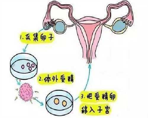女人做试管的最佳年龄：45岁去泰国供卵试管成功率高吗？