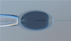 保定试管助孕*卵*孩子机构Top10排行