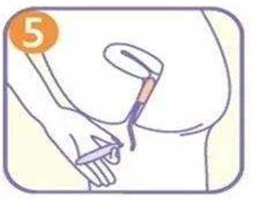 高龄残角子宫在沈阳做供卵试管可以不排队吗？附沈阳供卵试管医院名单