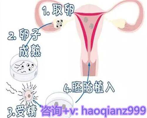 广州第三代供卵试管机构：哪种试管方案最好？有什么利弊？